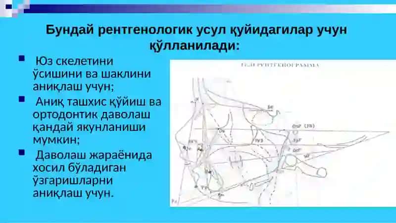 Телерентгенография 4