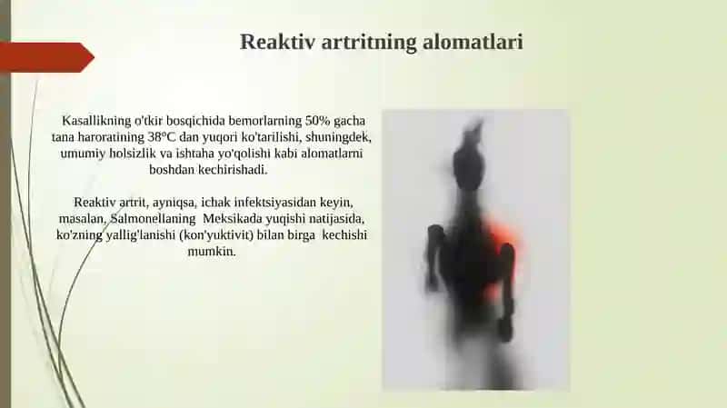 Reaktiv artritlar 4