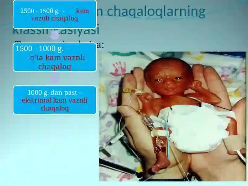 Chala tug’ilgan chaqaloqlar 4