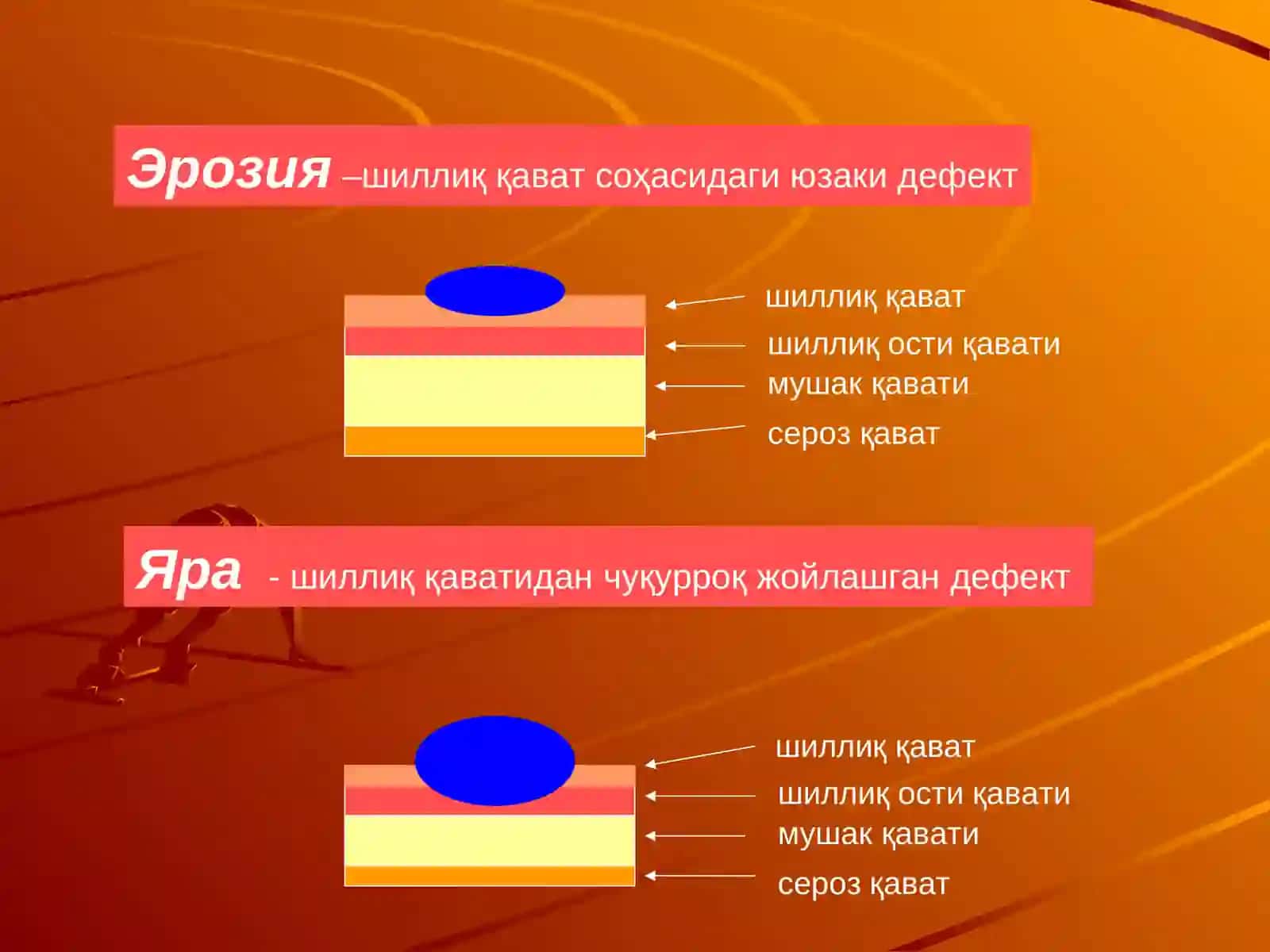 Меъда-ичак йулидан кон кетиш синдроми 4