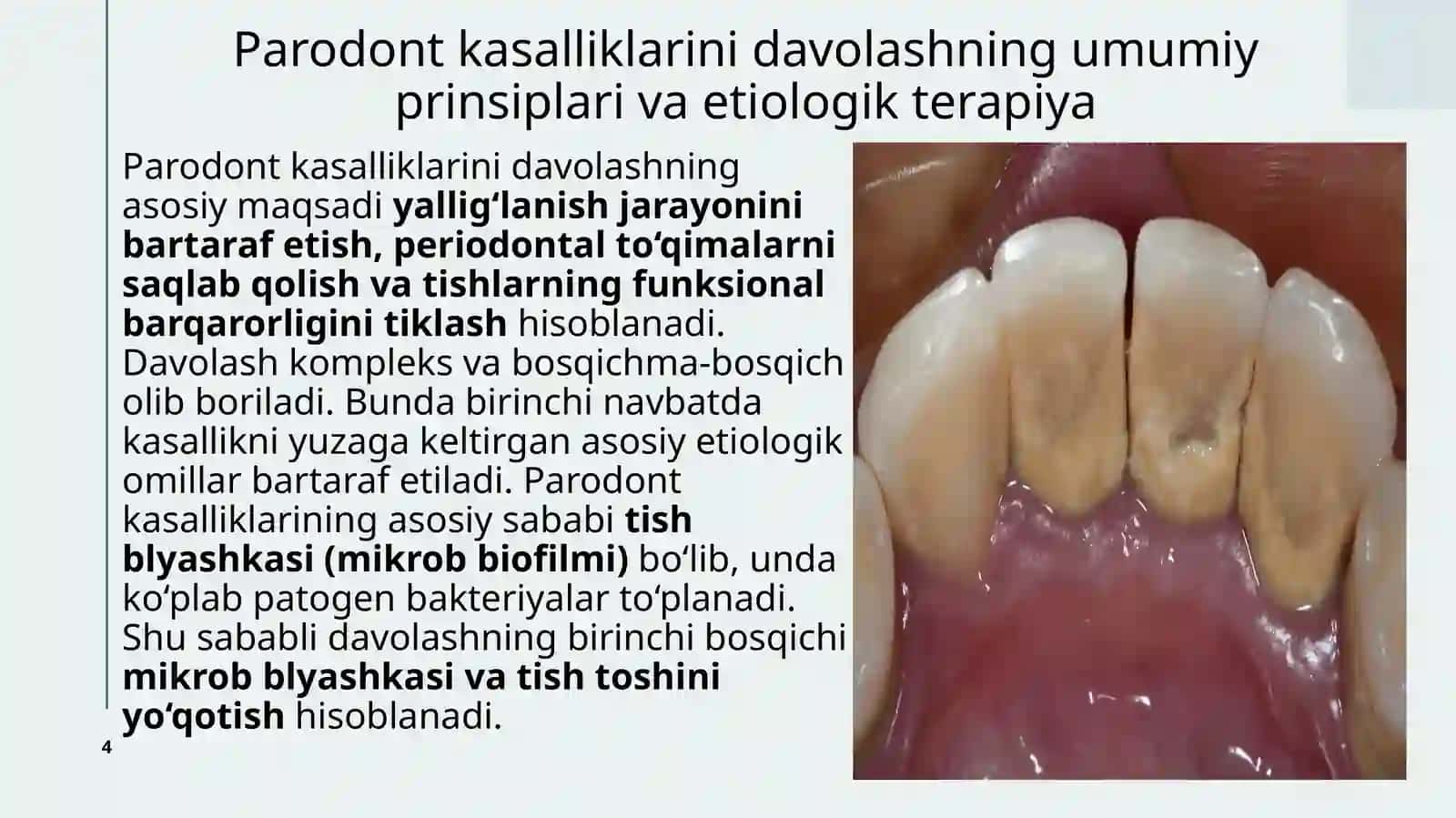 Parodont kasalliklarini davolash uchun zamonaviy usullar 4