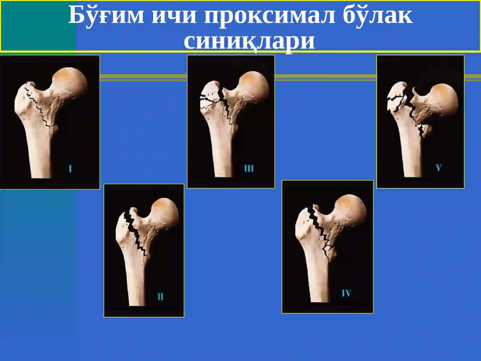 Сон,тизза,болдир ваоёқ панжа шикастлари 4
