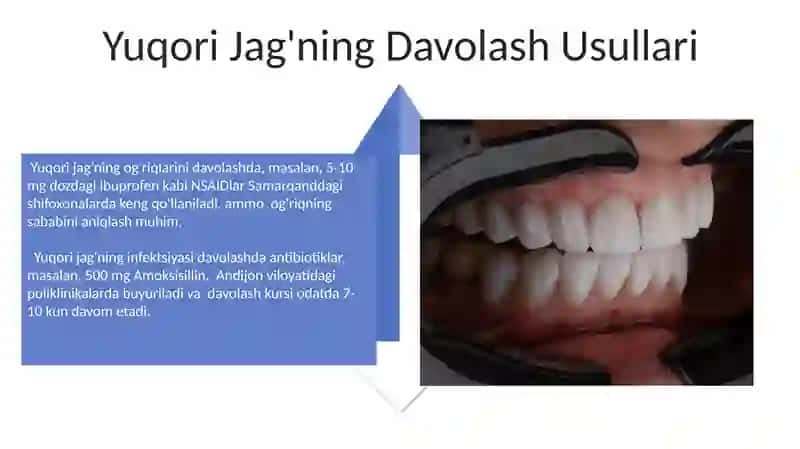 Yuqori jag'ning Anatomiyasi 4