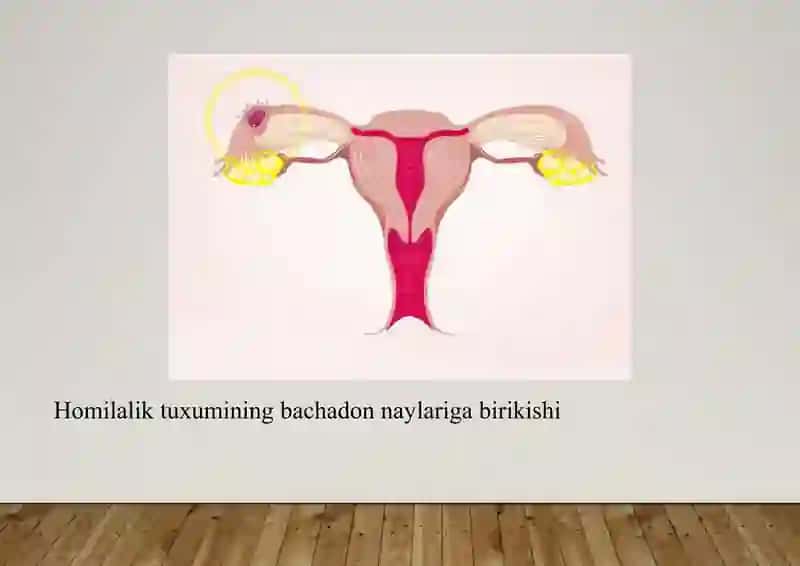 BACHADONDAN TASHQARI HOMILADORLIK 4