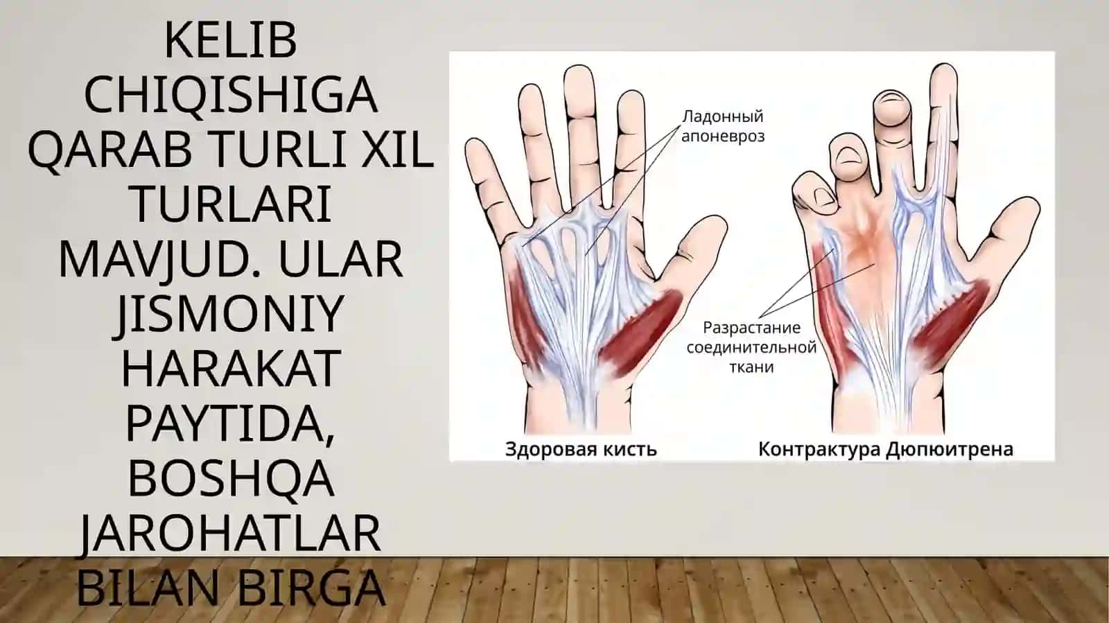 Bo‘g‘imlar kontrakturalari 4