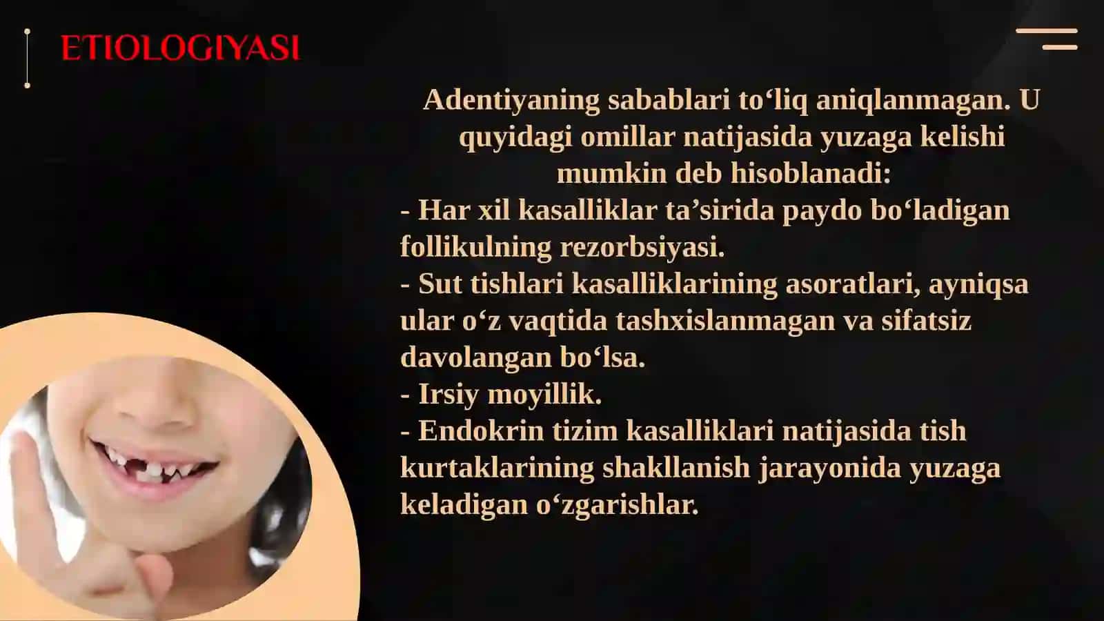 Ko‘p sonli birlamchi  adentiya va uning  tashxislash yo‘llari.  Angidrotik ektodermal displaziya. 4