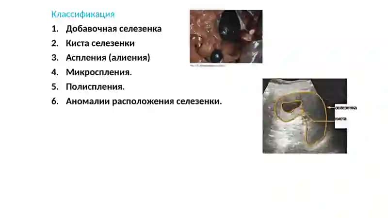 Taloq tug'ma nuqsonlari 4