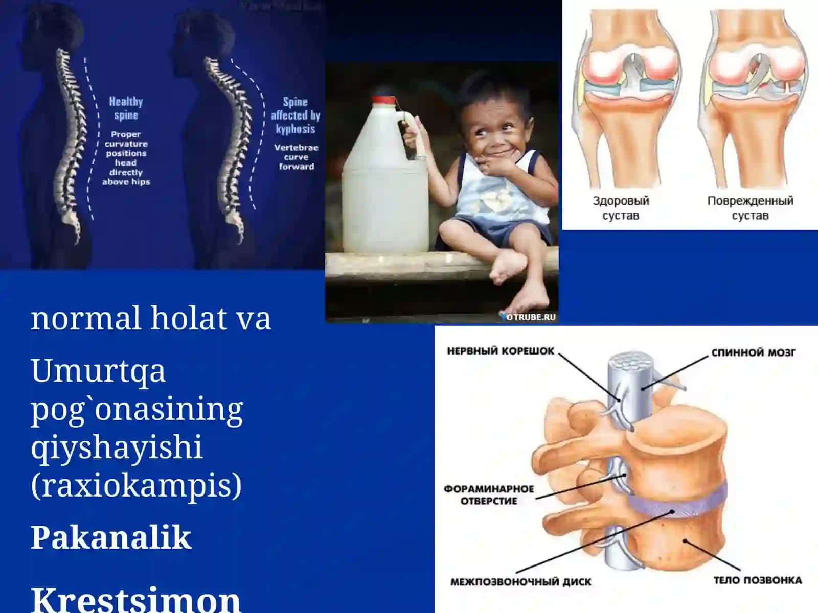 Tayanch Harakat Sistemasi Organlari 4