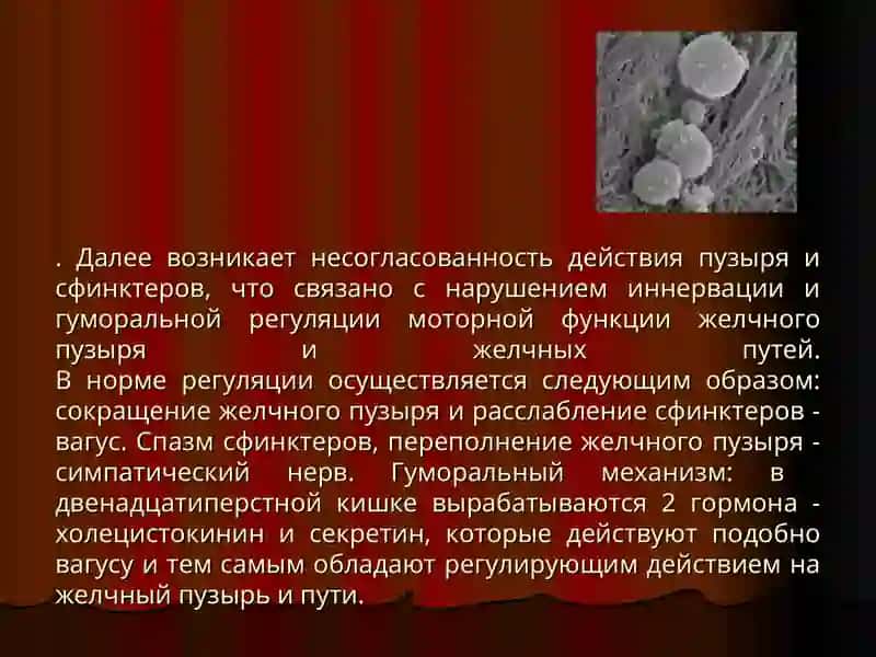 Механическая желтуха 4