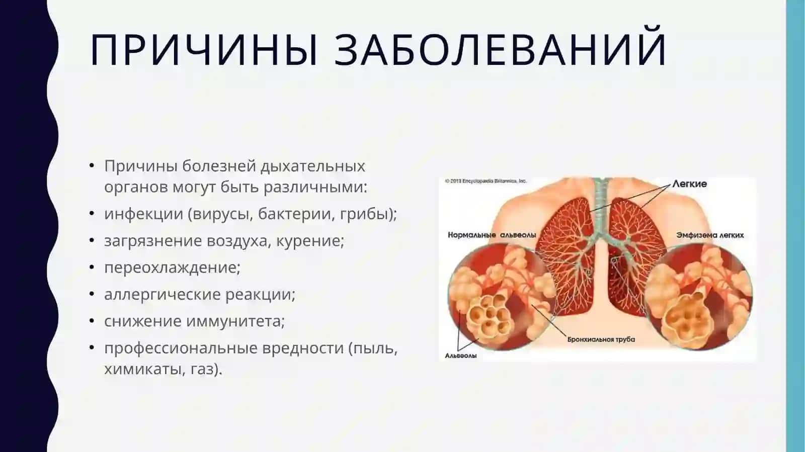 Заболевания органов дыхательной системы 4