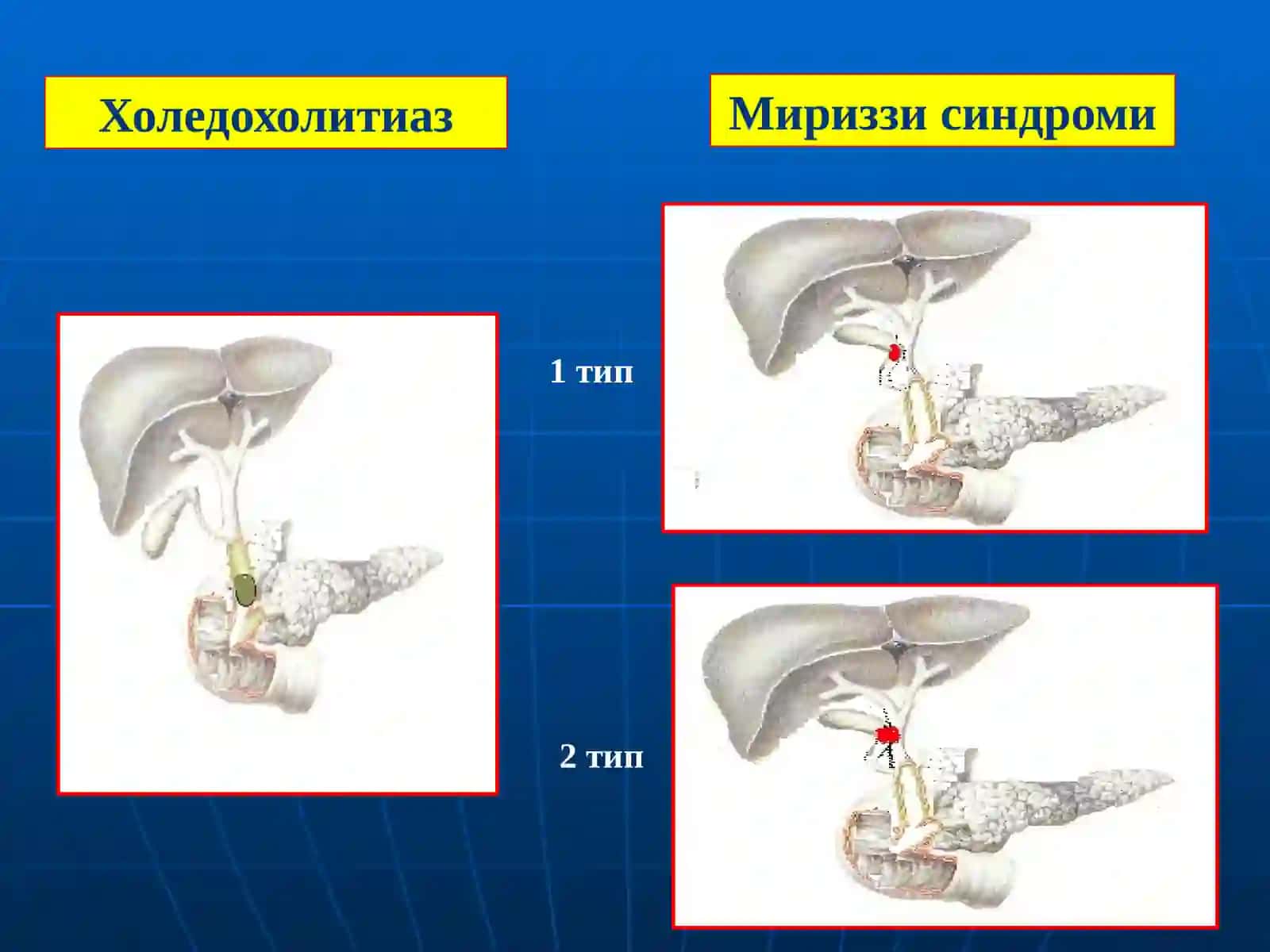 Механик сариқлик 4