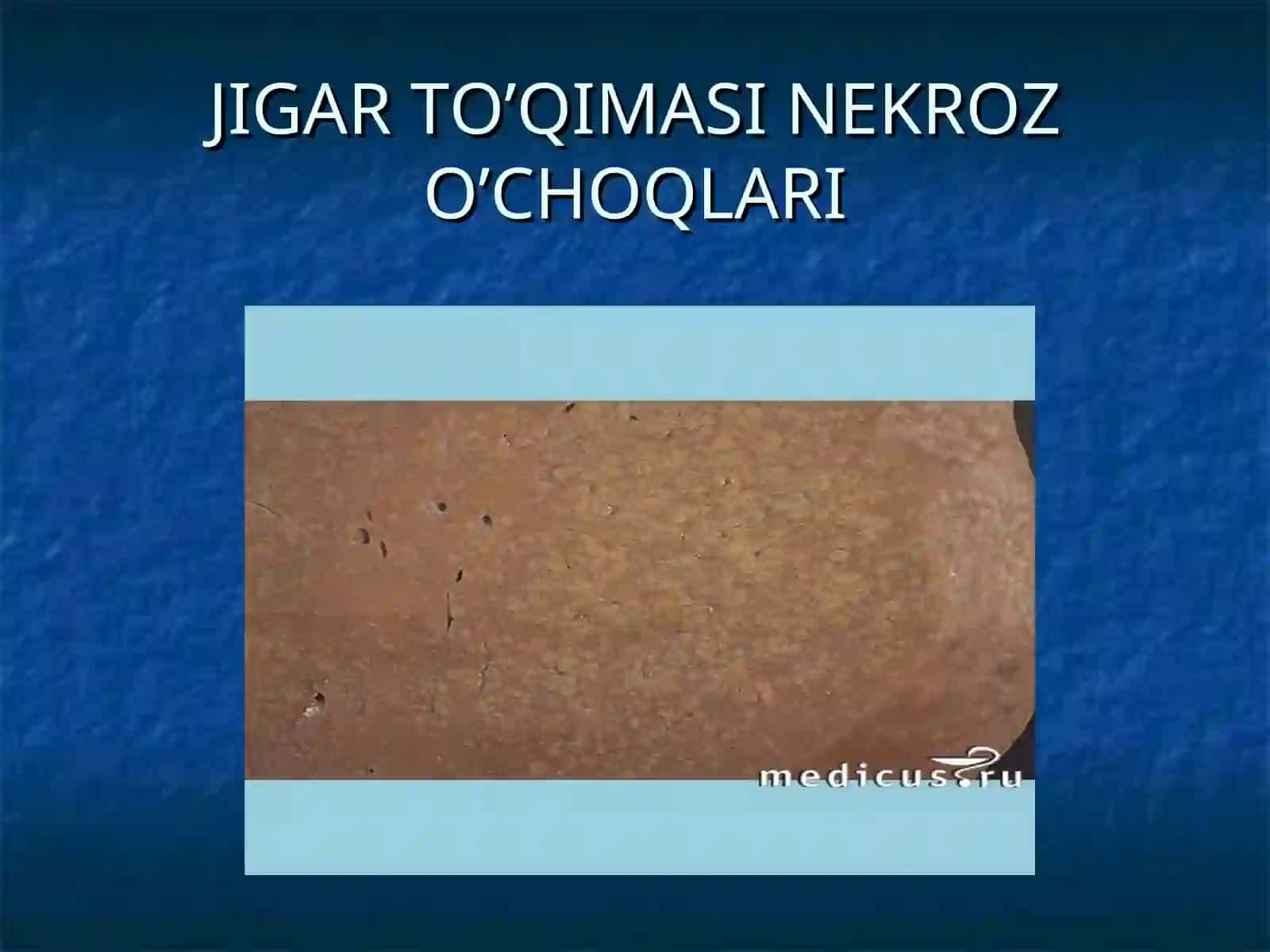 JIGARSIRROZI 4