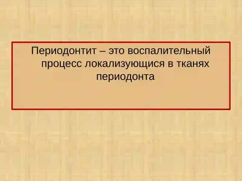 Периодонтит 4
