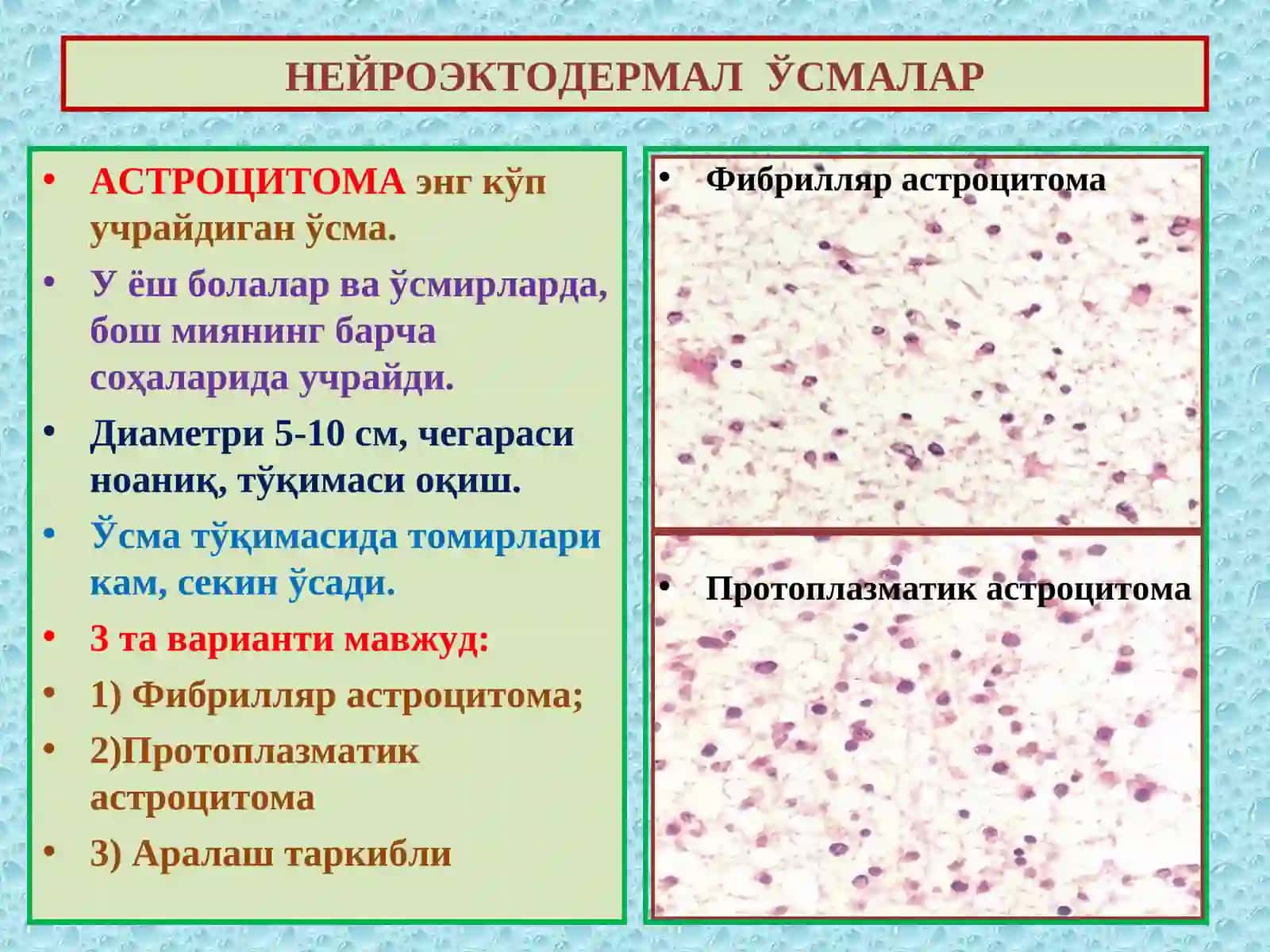 НЕРВ ТИЗИМИ ВА МИЯ ПАРДАЛАРИ ЎСМАЛАРИ 4