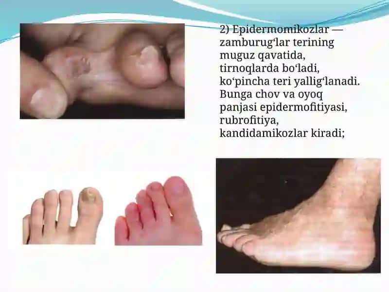 Terining zamburug‘li kasalliklari 4