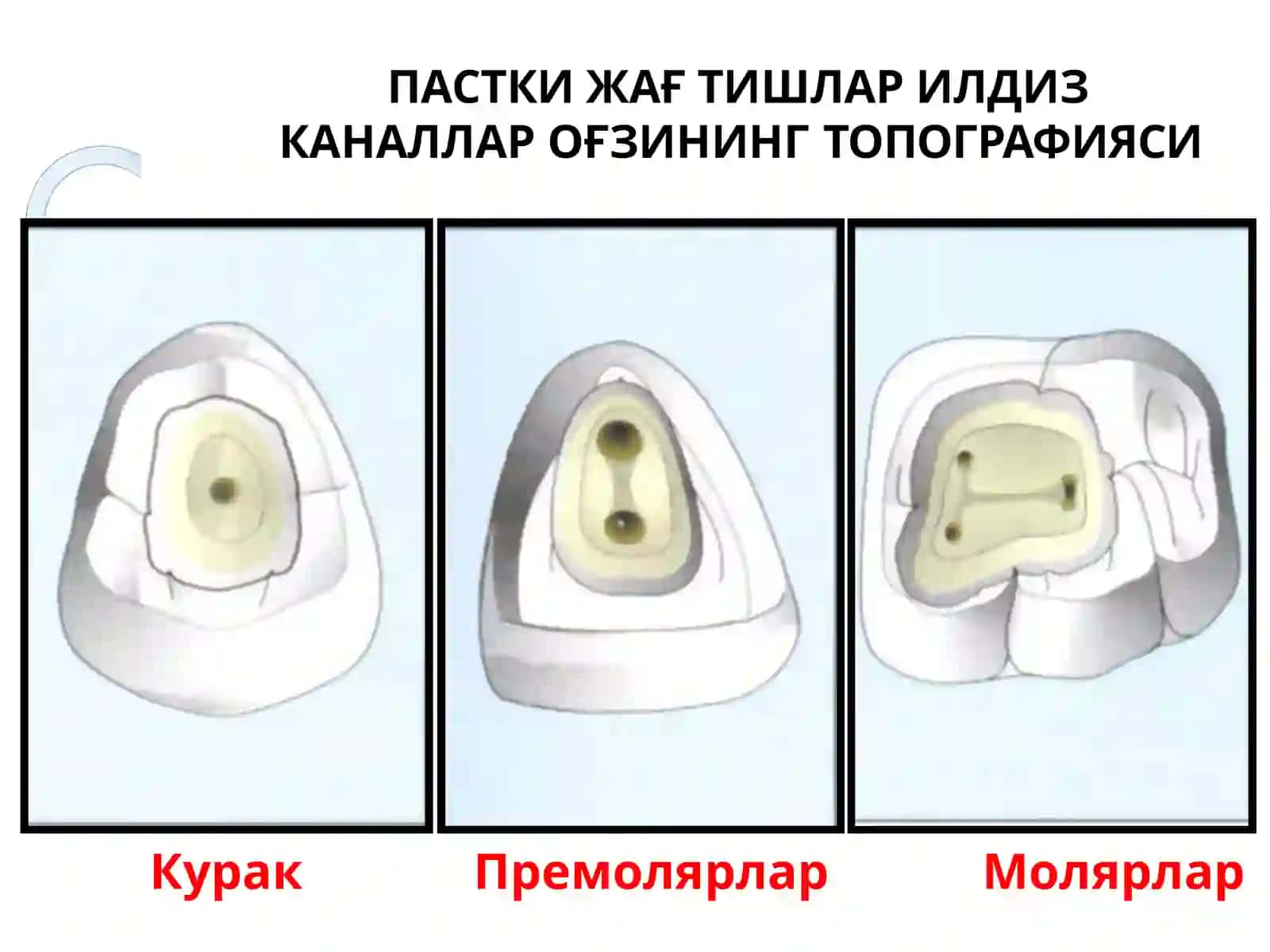 Илдиз каналига асбоблар ёрдамида ишлов бериш 4