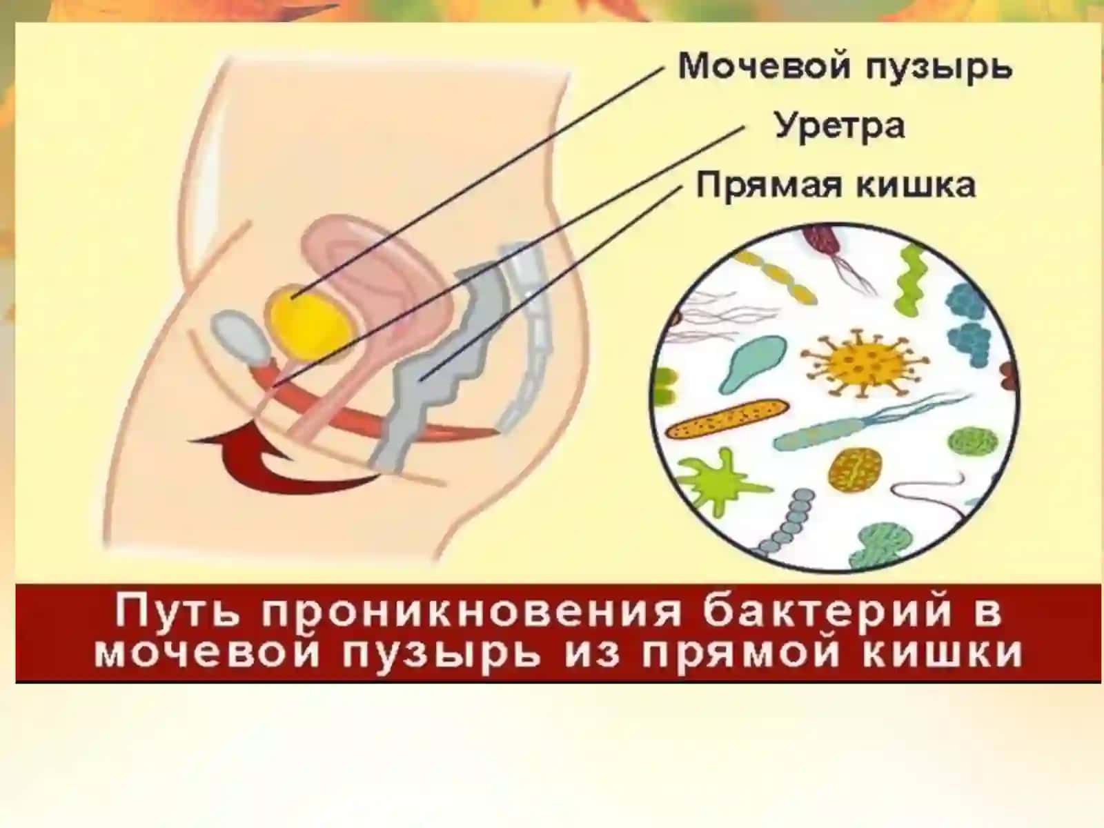 Siydik tanosil a’zolarining nospetsifik infeksion qo’zg’atuvchilari 4