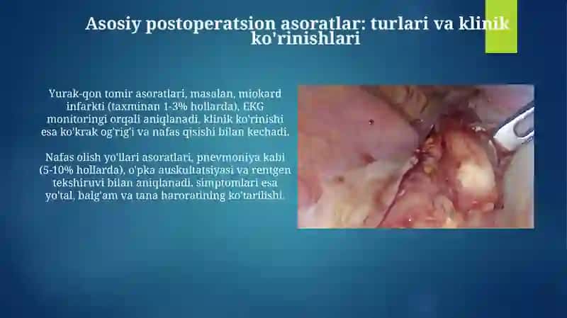 Asoratlar: Ta'rifi, tasnifi va xavf omillari 4
