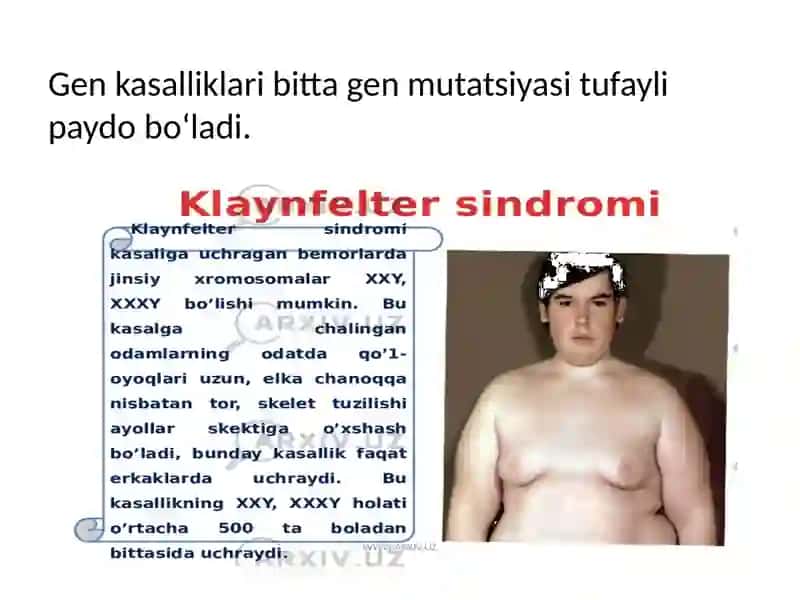 Irsiy kasalliklar 4