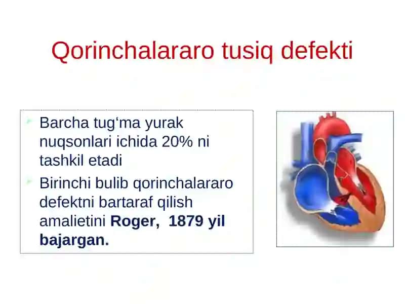 Tug'ma yurak nuqsonlari 4