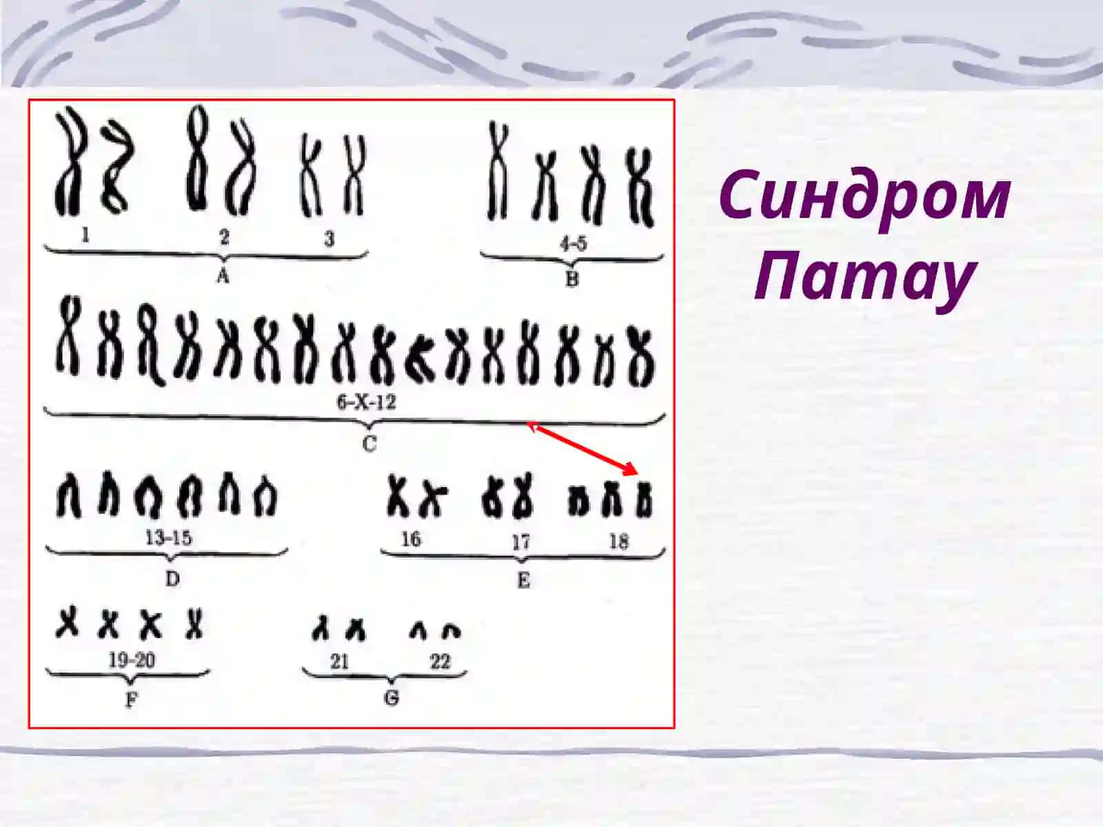 Пре- и перинатальная патология 4