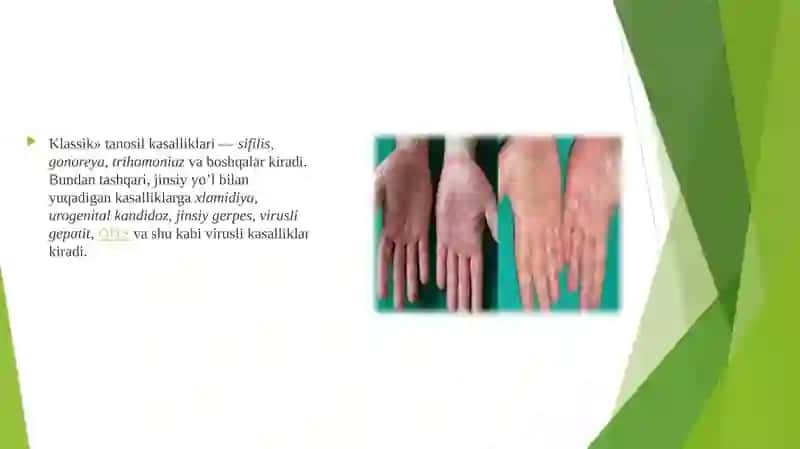 Tanosil kasalliklar 4