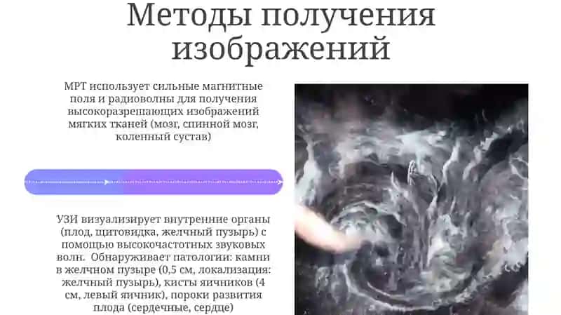 Внутренняя картина болезней 4