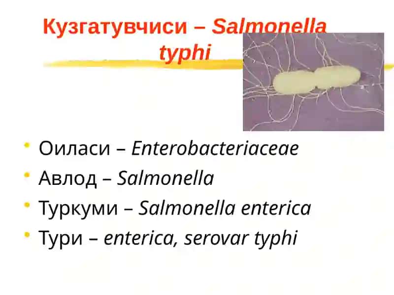 Ич терлама –қорин тифи (typhus abdominalis) 4