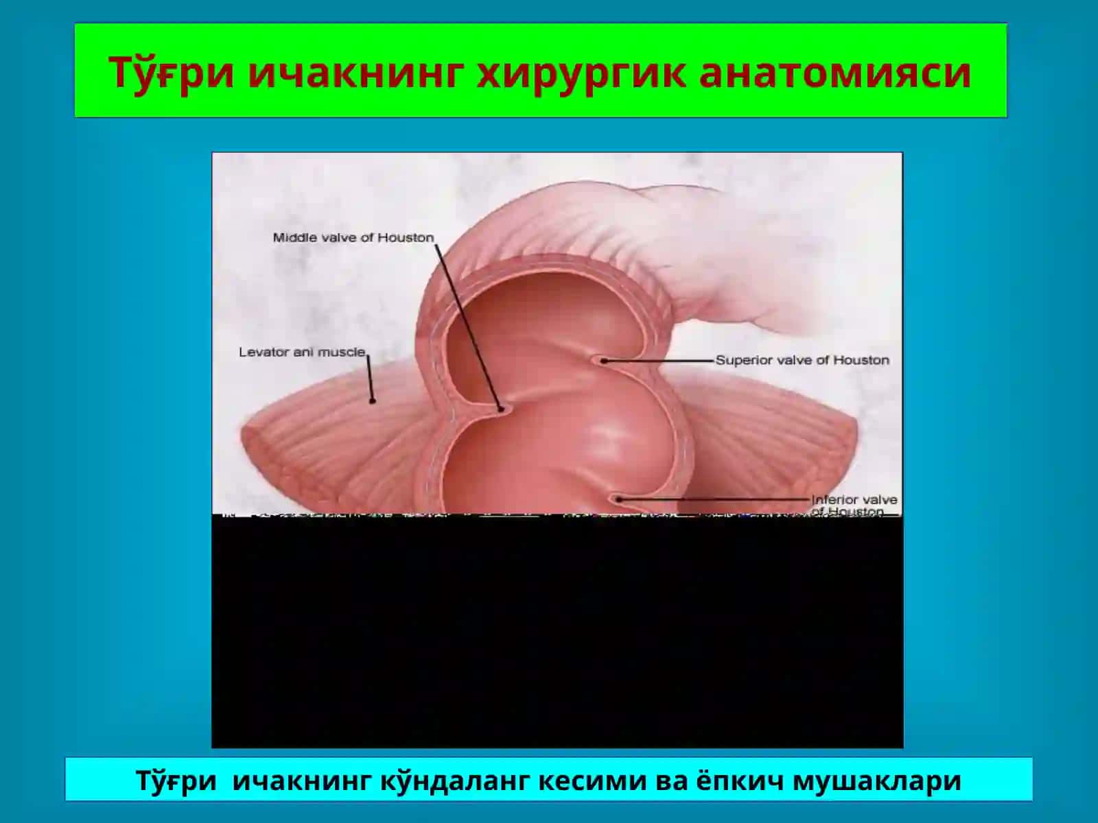 Тўғри Ичак Касалликлари 4