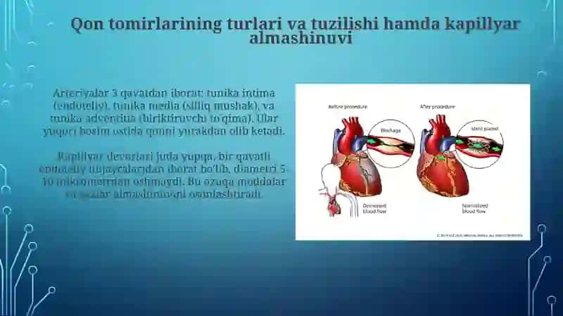 Sun'iy yurak 4