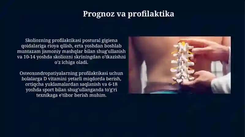 Osteoxondropatiyalar.Skolioz 4