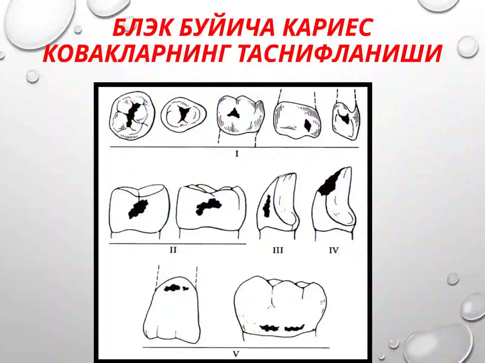 Кариесковакларнинг чархлаш-вапломбалаш 4