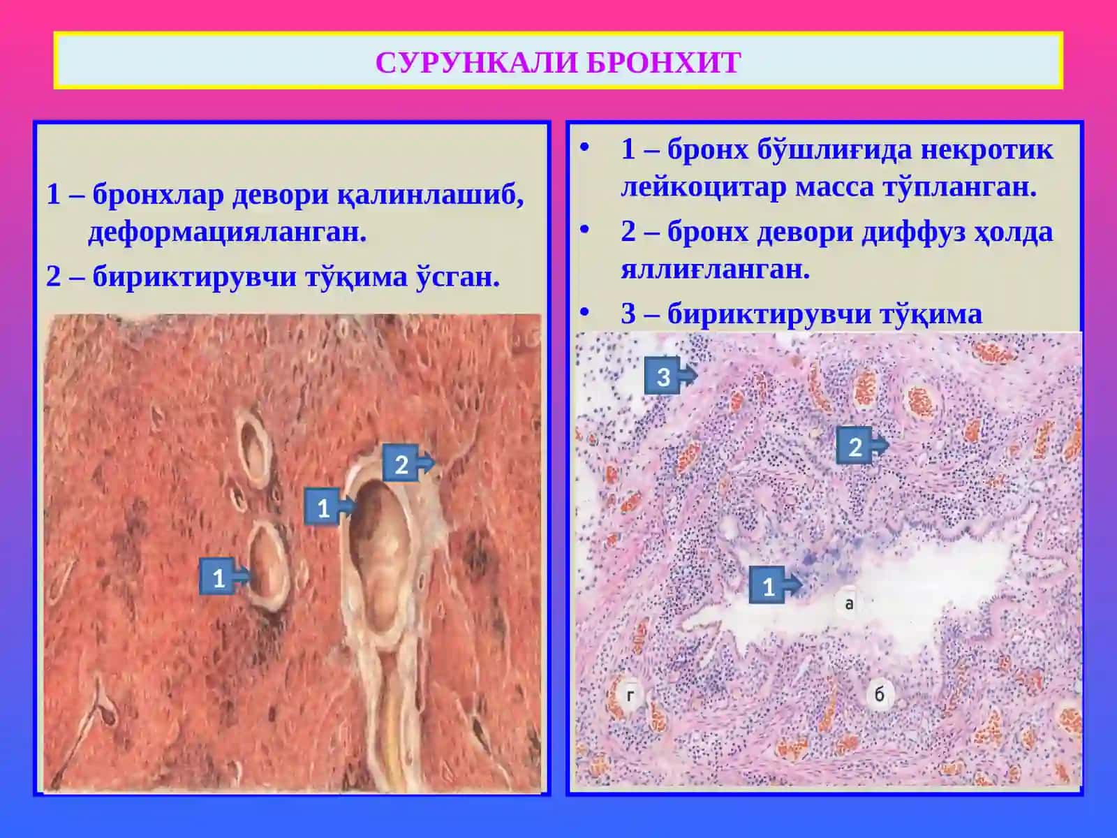 ПАТОЛОГИК АНАТОМИЯ 4