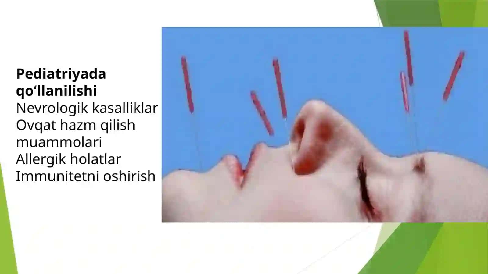 Pediatriyada ignaterapiyaning ahamiyati | Tayyor PPT prezentatsiya 4