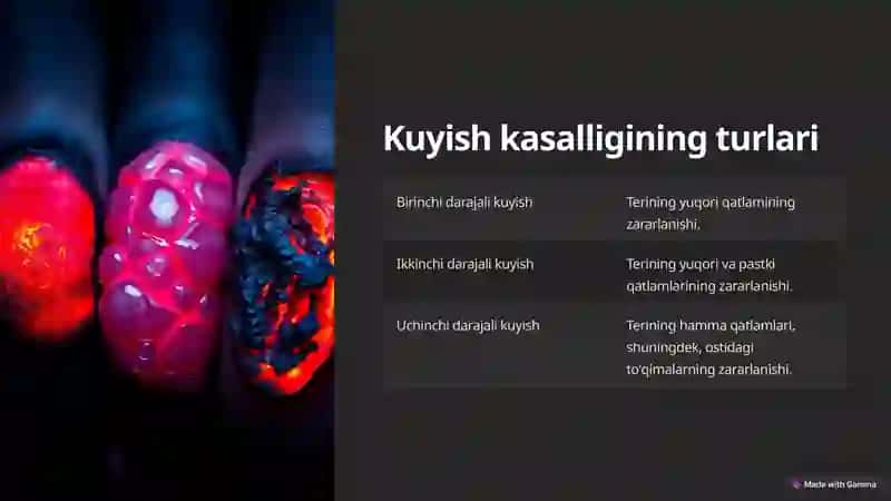 Kuyish kasalligi 4