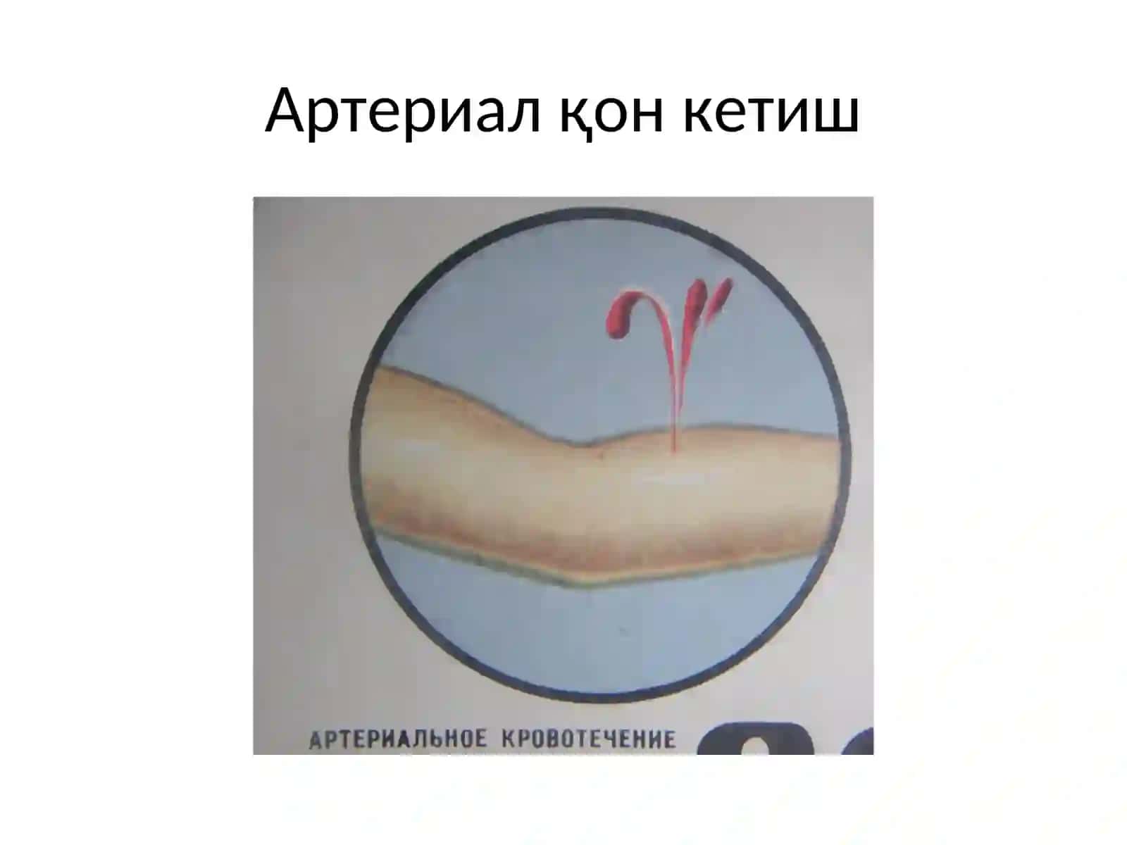 Қон кетиш 4