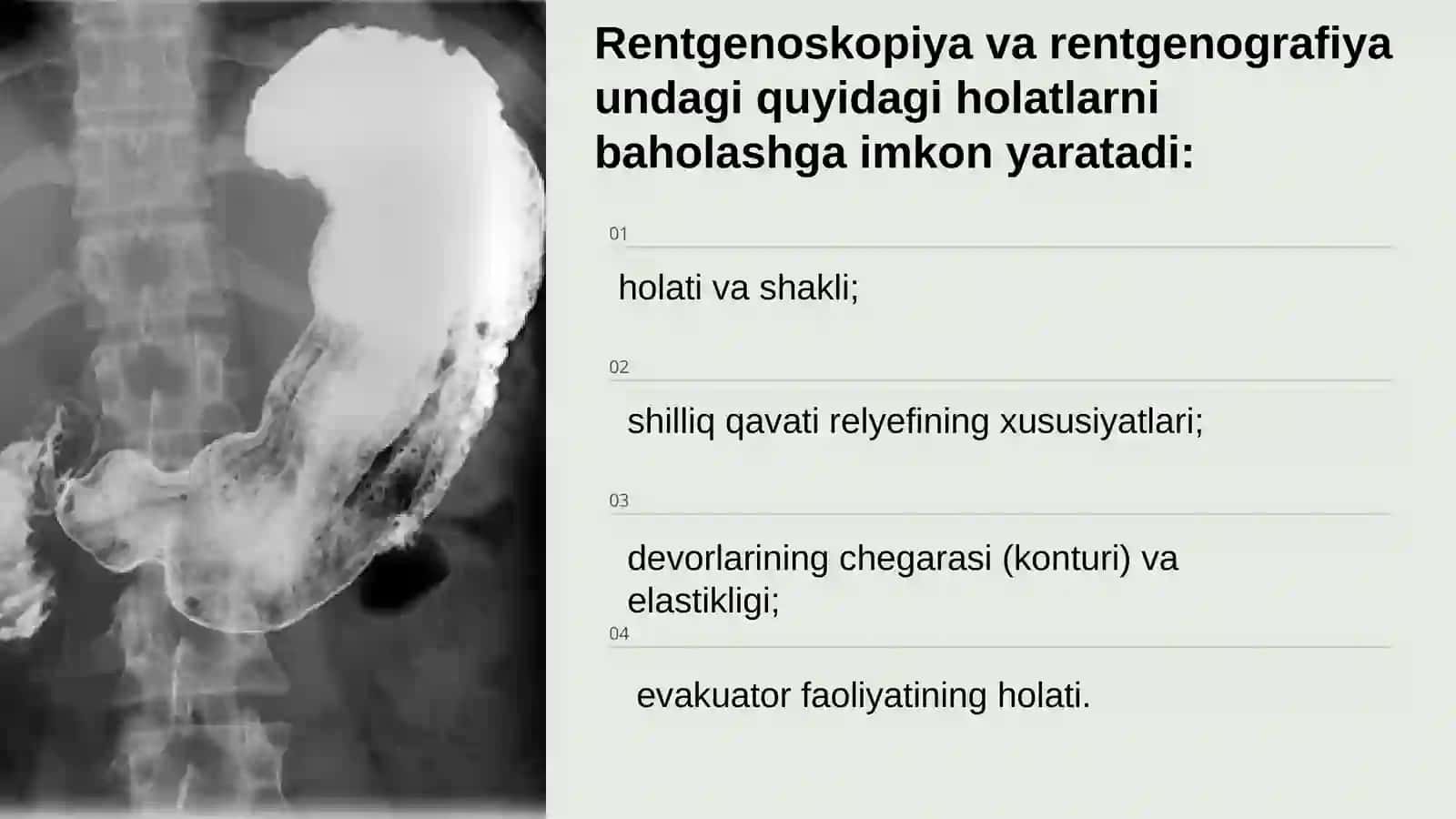 OSHQOZON RENTGENOLOGIK TEKSHIRUVI 4