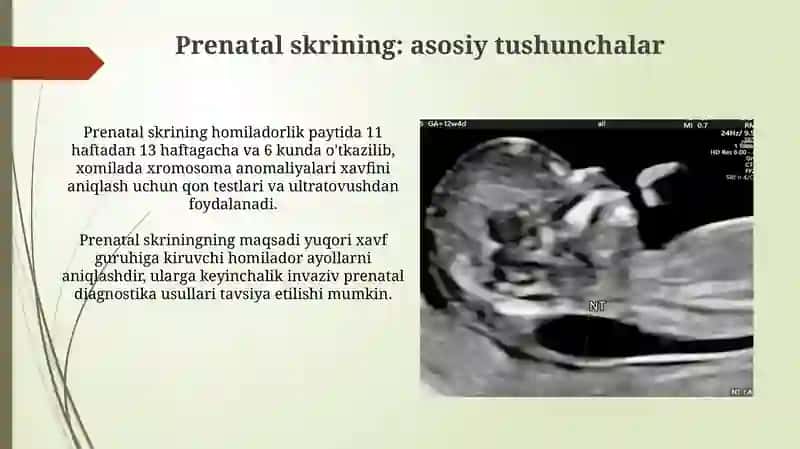 Prenatal diagnostika 4