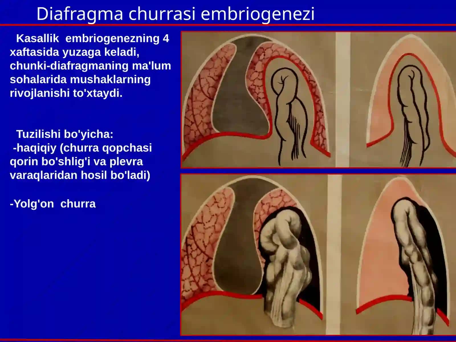 BOLALARDA DIAFRAGMA CHURRASI 4