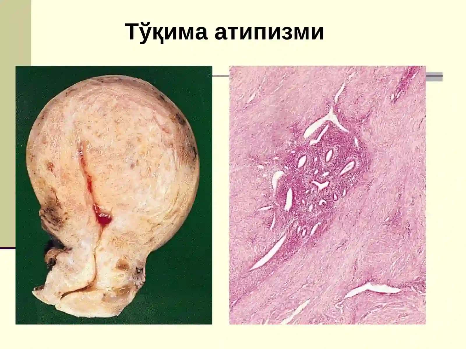 Онкология 4