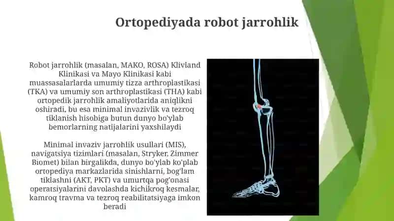 Zamonaviy ortopediya yutuqlari 4