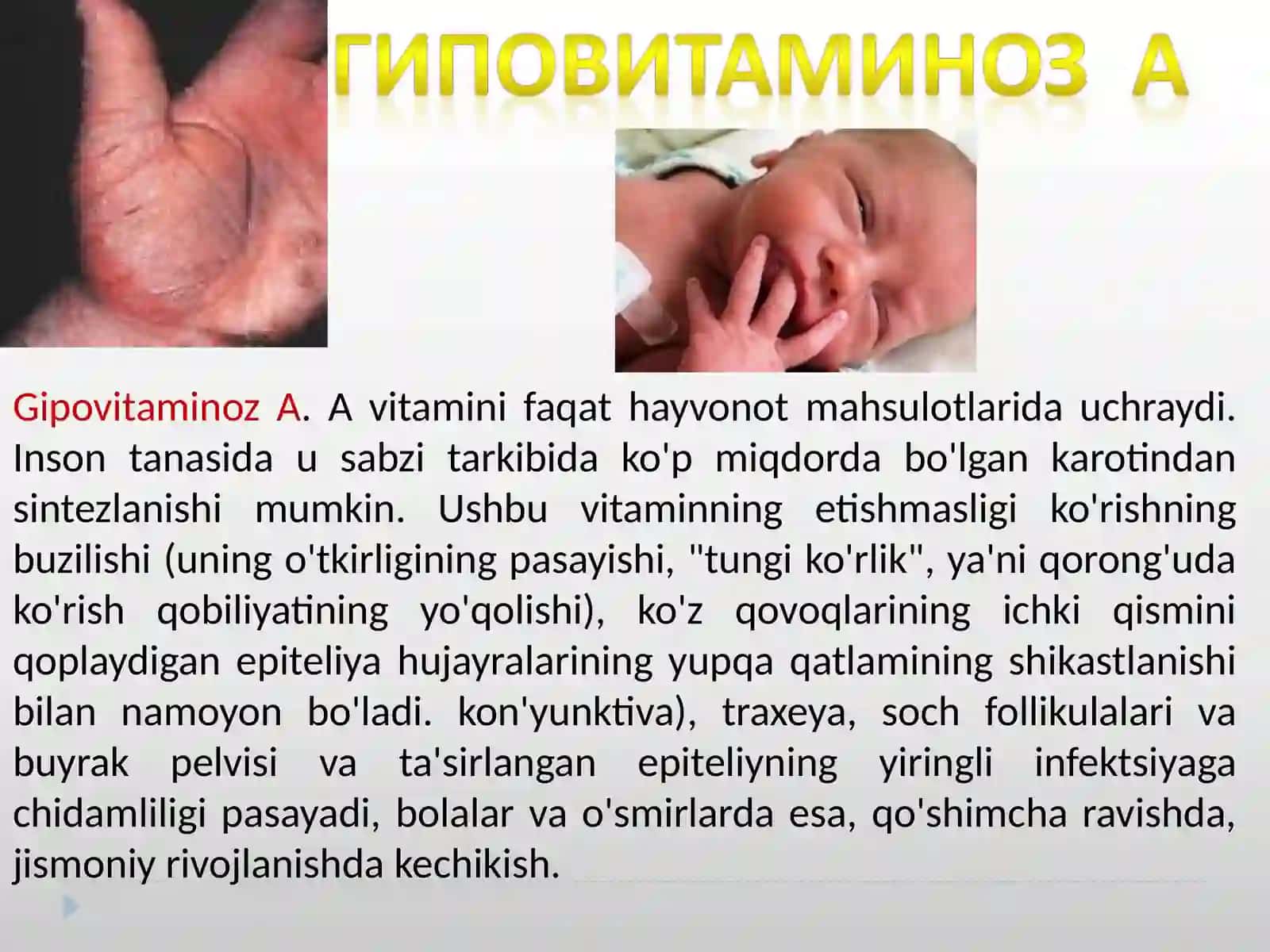 Gipovitaminoz 4