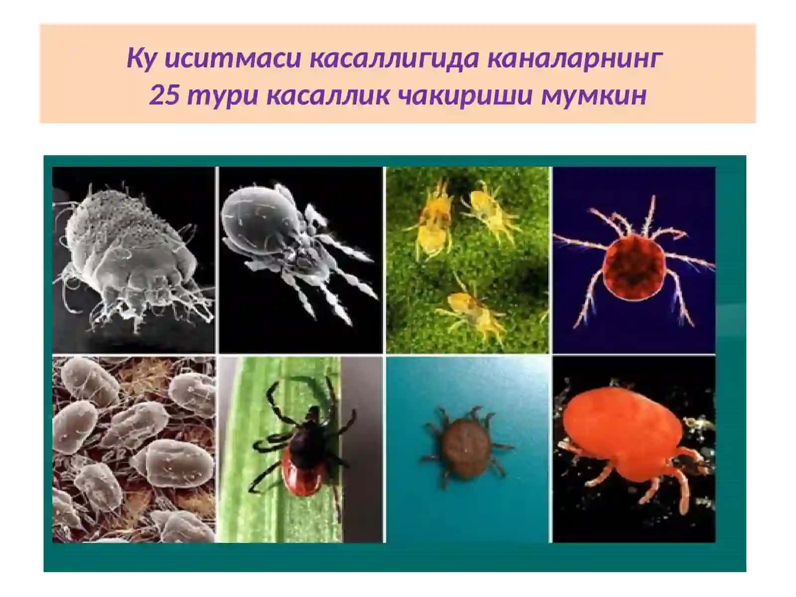 Ку иситмасининг эпидемиологияси ва профилактикаси 4
