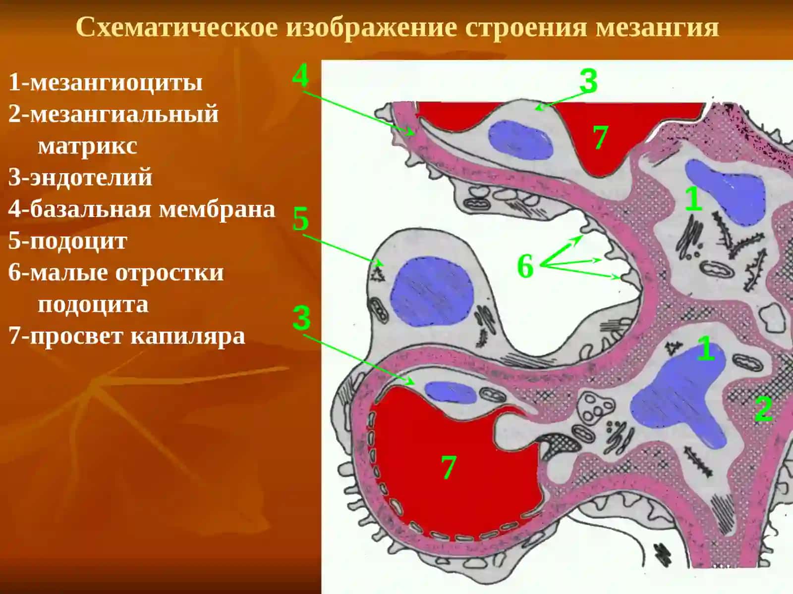 Хронический гломерулонефрит 4