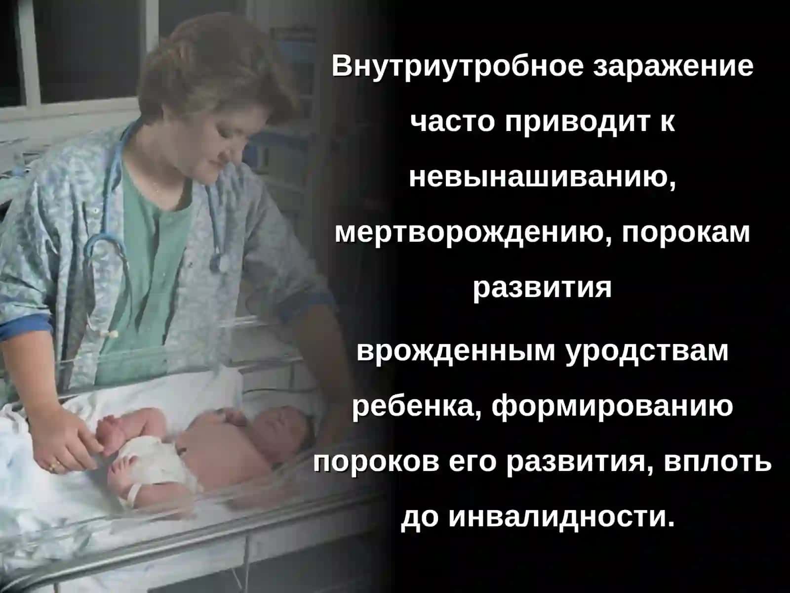 ТОРСН-комплекс 4