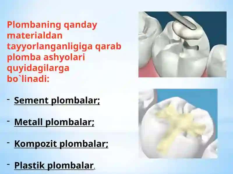 Zamonaviy Kompozit Plombaashyolari 4