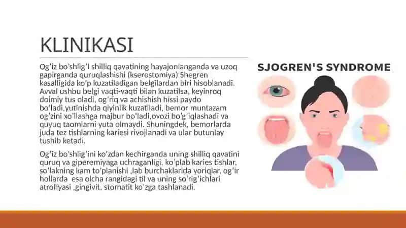 SHARP SINDROMI. SHEGREN KASALLIGI 4