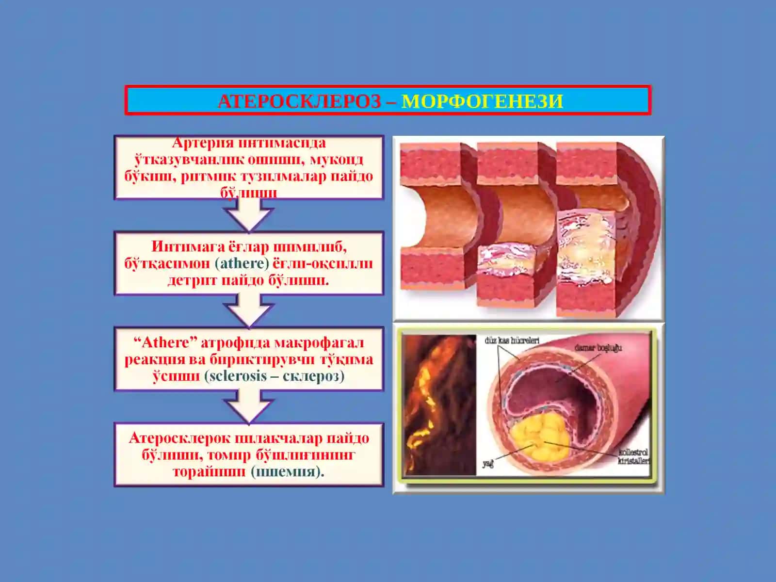 ПАТОЛОГИК АНАТОМИЯ 4
