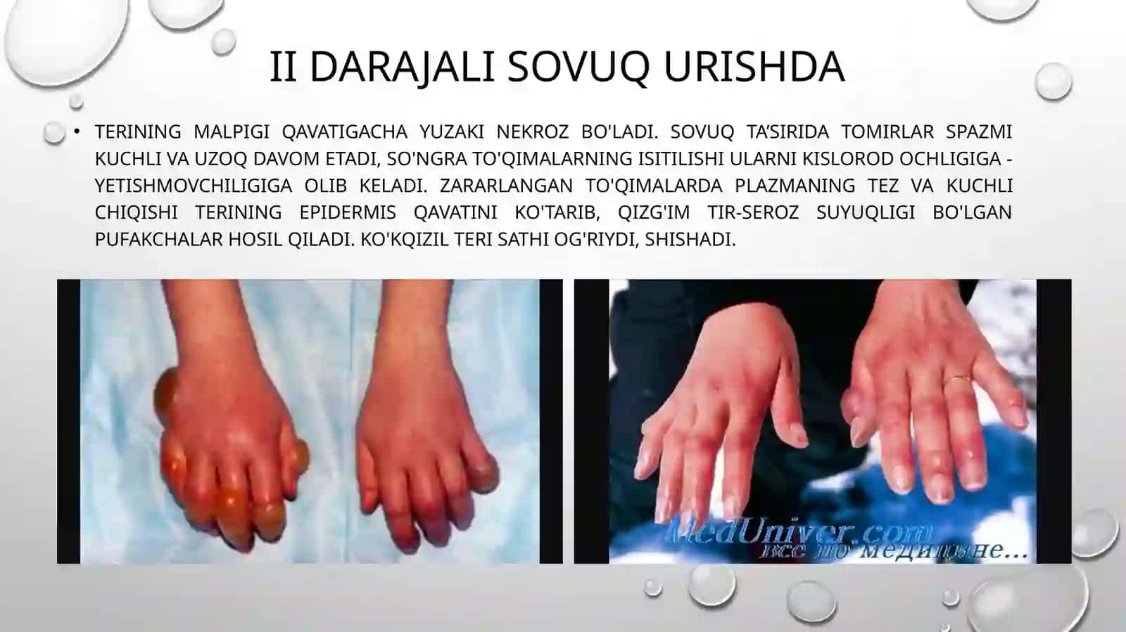 Sovuq urish belgilari 4
