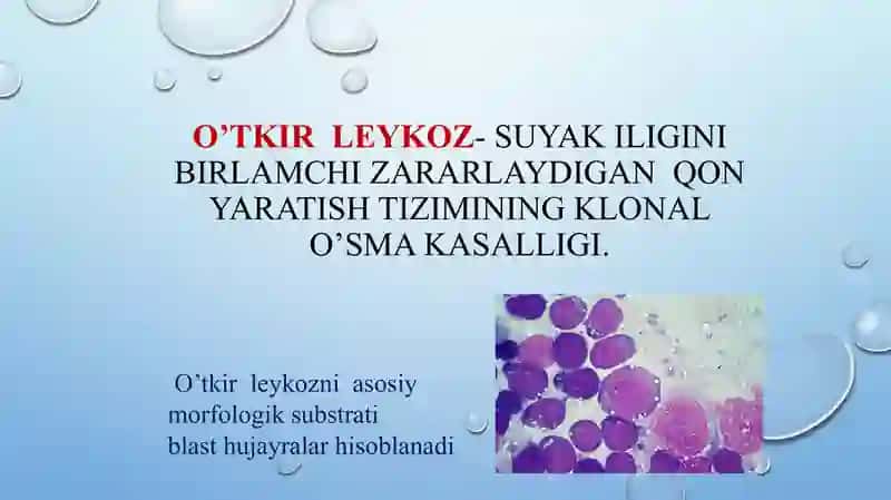 Kattalarda o’tkir leykozlar.  Diagnostikasi va davolash tamoyillari 4